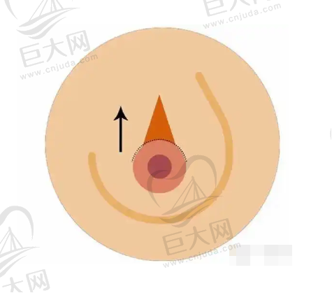 与当地其他整形医院对比