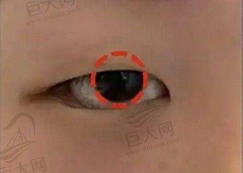 焦作俪人医疗美容诊所可开展的项目