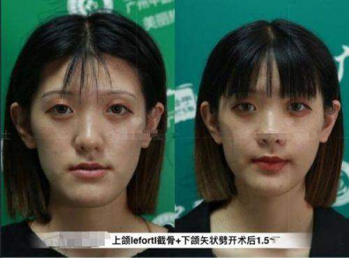 与其他医院对比