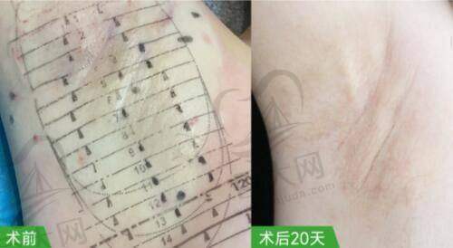 烟台伯仕医疗美容门诊部2025年价格表