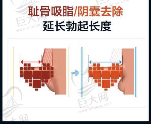 宿迁黎明医疗美容门诊部服务领域