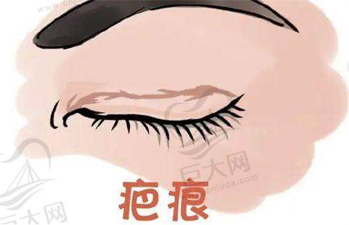 综合评估