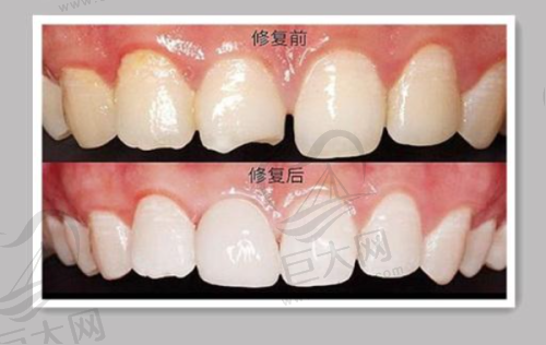 穗华口腔医院的项目价格