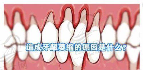 厦门五缘湾登特口腔医院怎么样？地址、价格、服务全揭秘，还有患者真实评价！