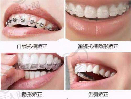 深圳福田马泷齿科营业时间与预约方式
