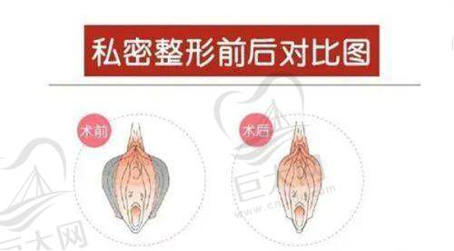 价格优势