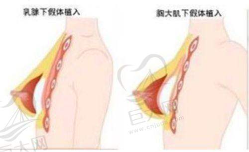 其他热门项目