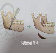 与其他医美机构对比