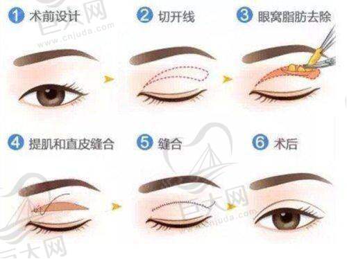 眼科情况
