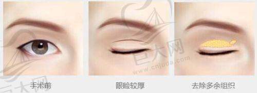 医疗资质
