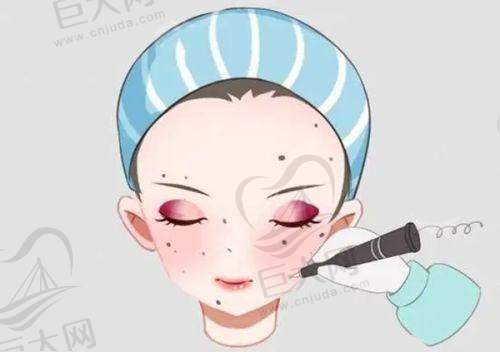 变得更美常见问题解答