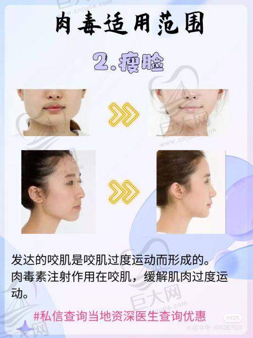 主打项目特色