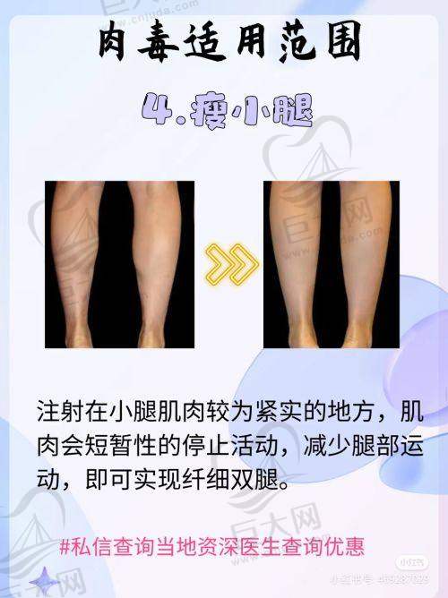 爱莱美门诊部靠谱吗？