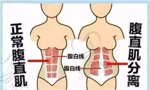汕头女性缩紧手术医院