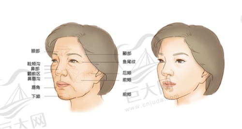 经典特色项目