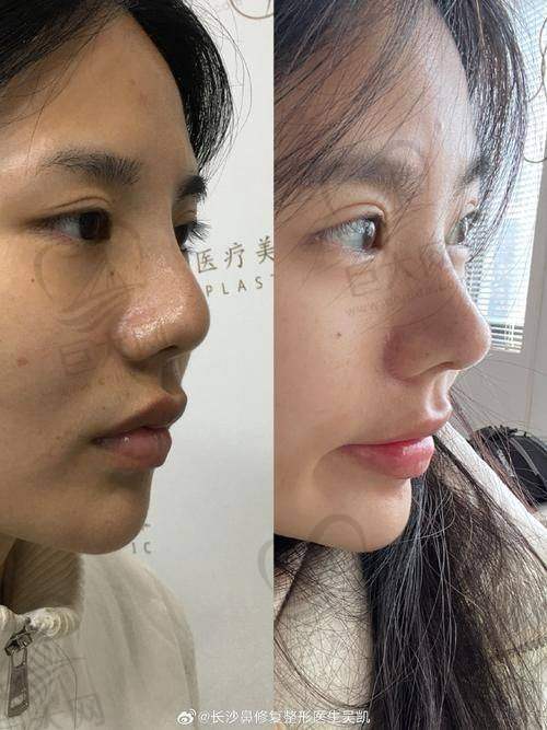 不同手术类型医生优势对比