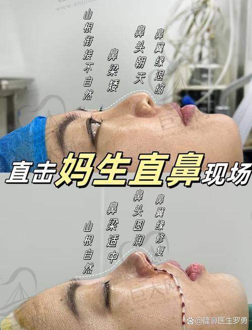 2025潍坊做鼻子优质医生排名大公开，涵盖垫鼻、鼻中隔矫正，速来了解 