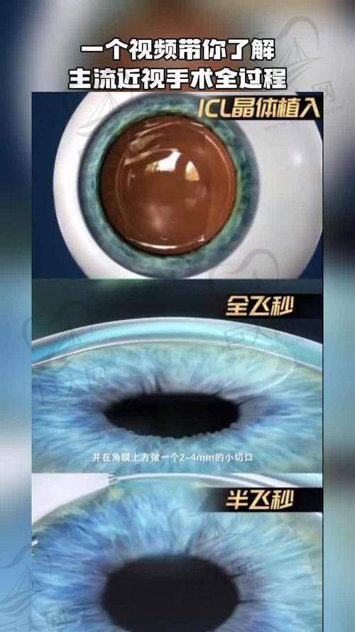 兰州眼科医院排名榜单公布！兰州爱尔/兰州普瑞/兰州华厦稳居私立眼科医院排名top3