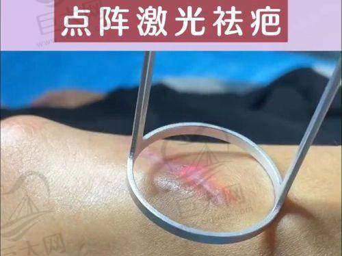 西安国际医学整形医院疤痕整形骨干医生