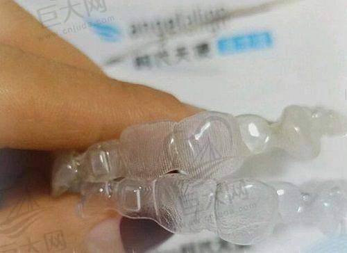 口腔诊所项目价格的未知之谜
