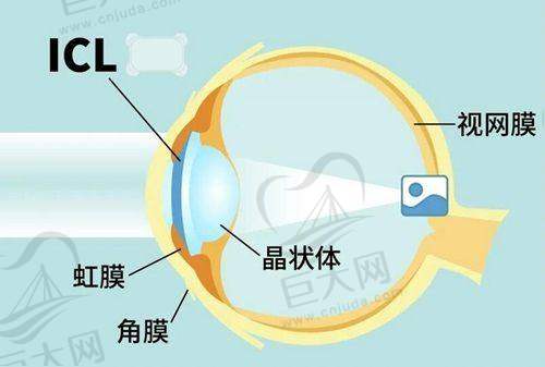 南充眼科医院排名前十的重要性