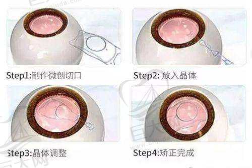 乌鲁木齐眼科医院排名前十推荐，乌市专门看近视眼、白内障、斜弱视等眼病的医院都在这