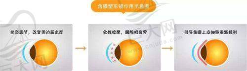 武汉眼科医院排名情况来了，艾格排靠前，爱尔、普瑞也上榜，还有两家私立眼科价格便宜