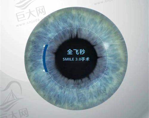 黄冈市中 心医院眼科的服务质量