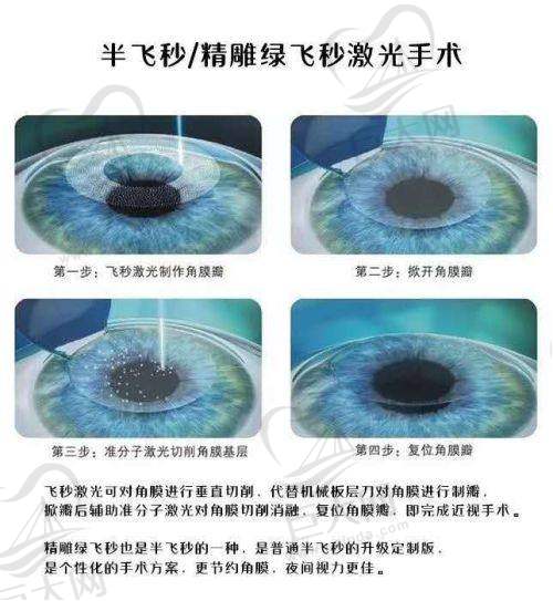株洲爱尔眼科医院荷塘门诊部
