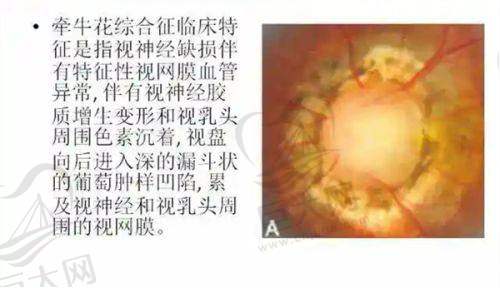 南充爱尔麦格眼科的情况