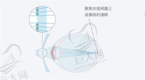 选择合适的六安眼科医院特别重要