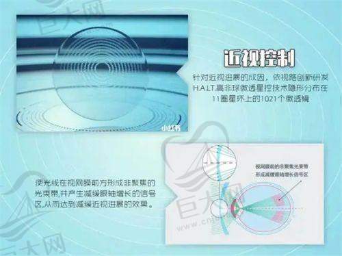 10岁孩子近视改善实例