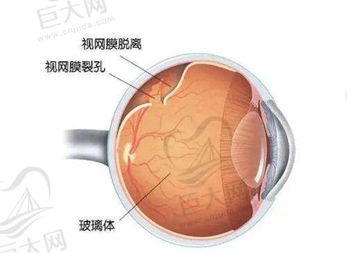 襄阳眼科医院排名咋样哪家好，艾格是私立专科激光手术口碑好，爱尔在樊城区建设路