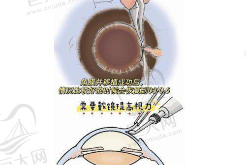 电话预约挂号方式