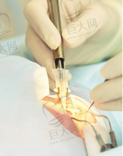 常见眼科疾病的治疗