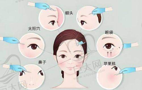 综合考量值得一试