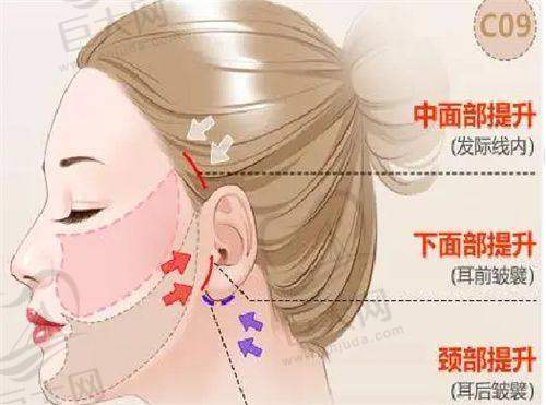 与其他医院对比优势
