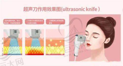 医院声誉与公益活动
