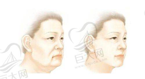 价格优势