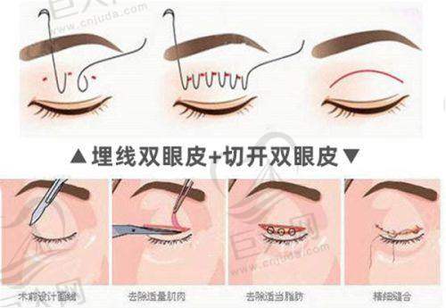 郑州抗衰美容整形医院情况