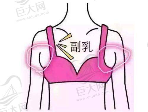 私密整形术后护理科普