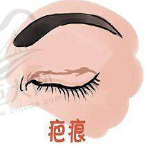 眼部整形项目价格参考