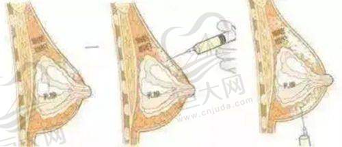 丰苹果肌项目分析