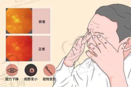 2025年邢台近视眼手术医院预约挂号