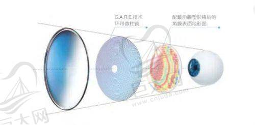 依视路星趣控与其他品牌对比