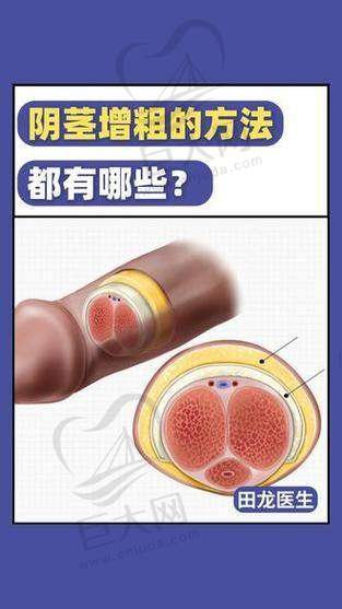 男科手术预约挂号方式