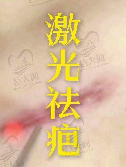 专精祛疤能力证实正规