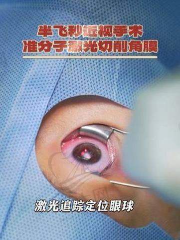 杭州茗视佳眼科门诊情况