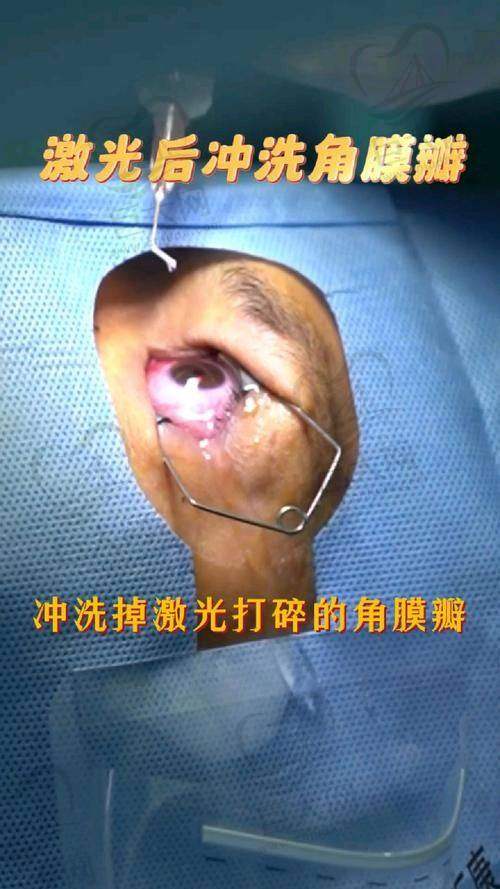 浙江杭州黑马眼科优势