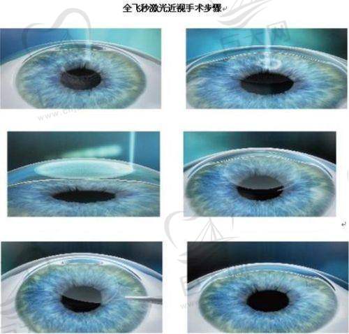 2025年商洛眼科医院各院区常规、节假日上班时间全揭秘，含激光手术及急诊安排